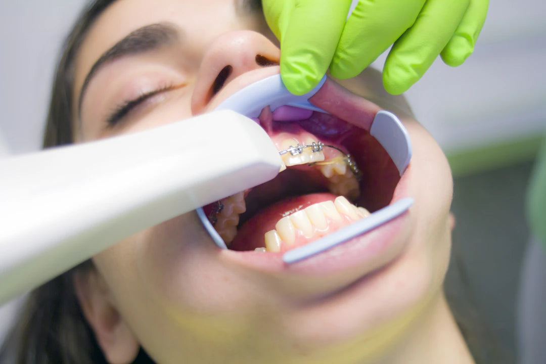 Why Dentists Recommend Mouth Taping for Better Sleep